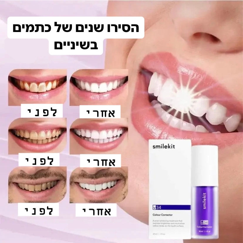 WhiteSmile Pro- מלבין שיניים